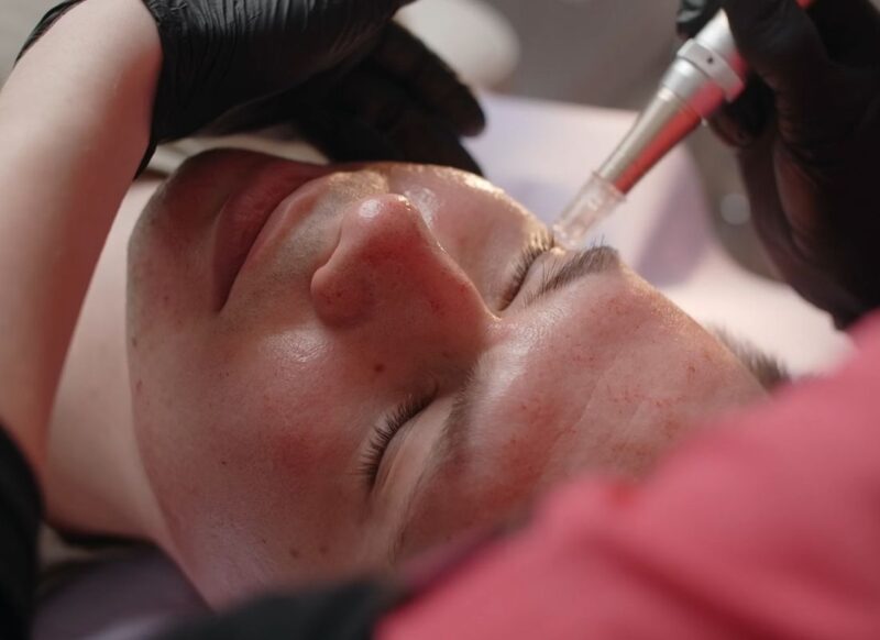 devojka na tretmanu lica