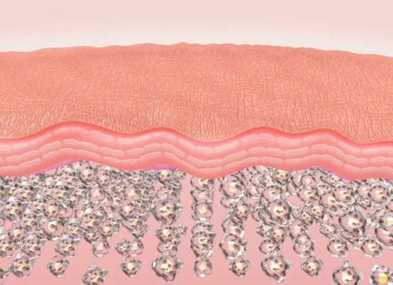 prikaz starenja kože